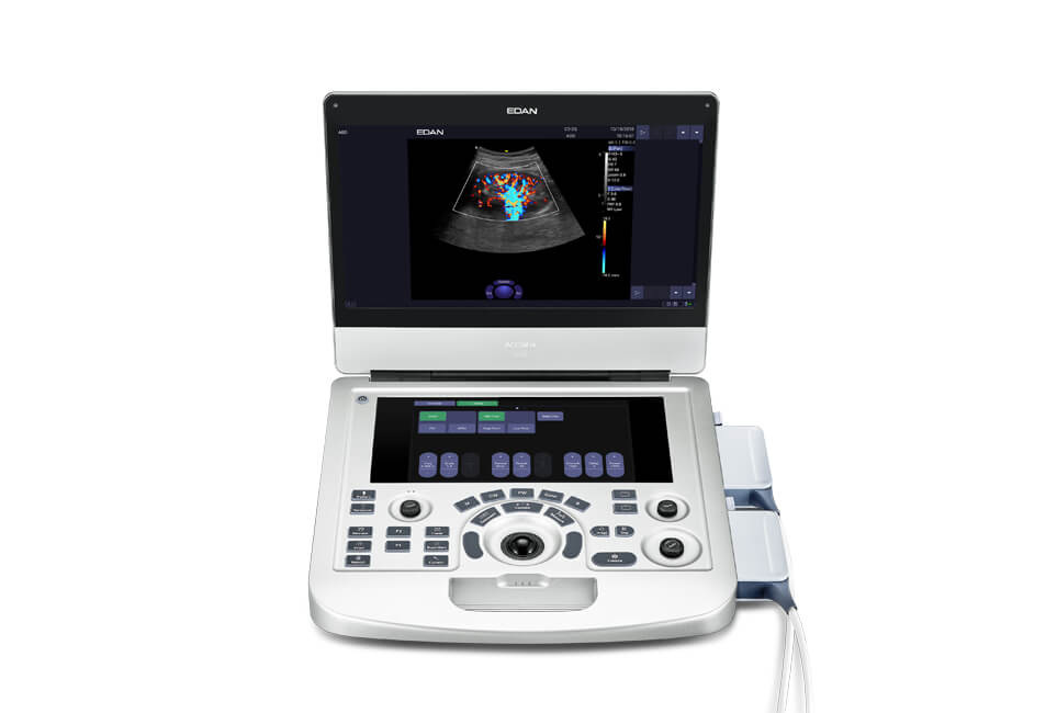 AX2 AX3 Portable Color Ultrasound