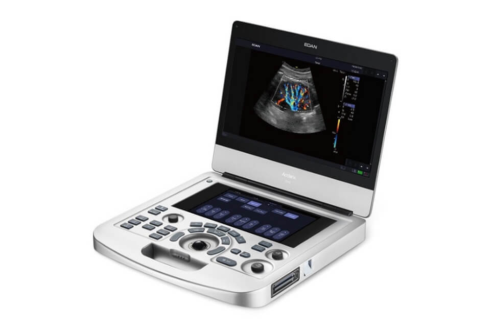 Portable Color Doppler Ultrasound Machine