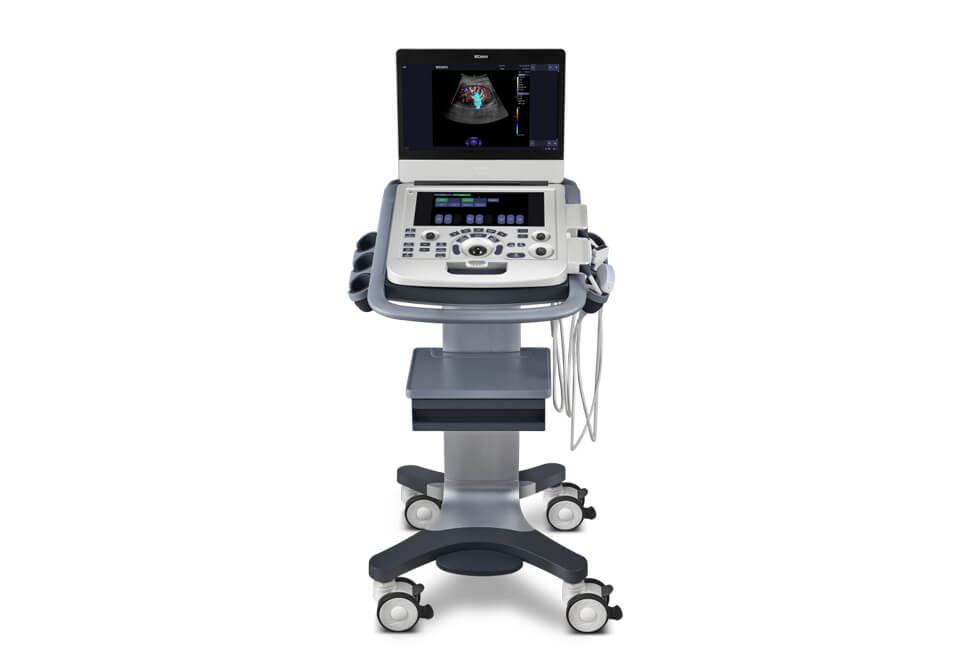 Color Doppler Ultrasound Scanner