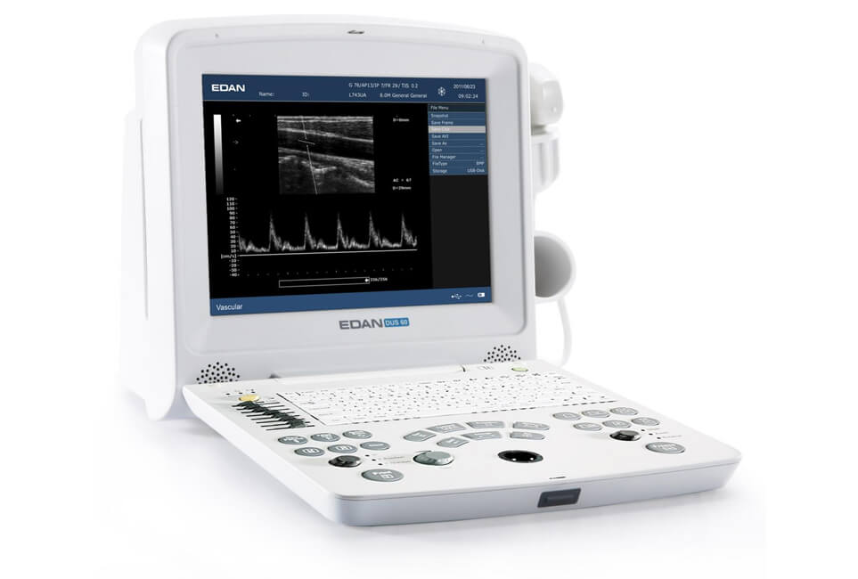 DUS60 B/W Ultrasound