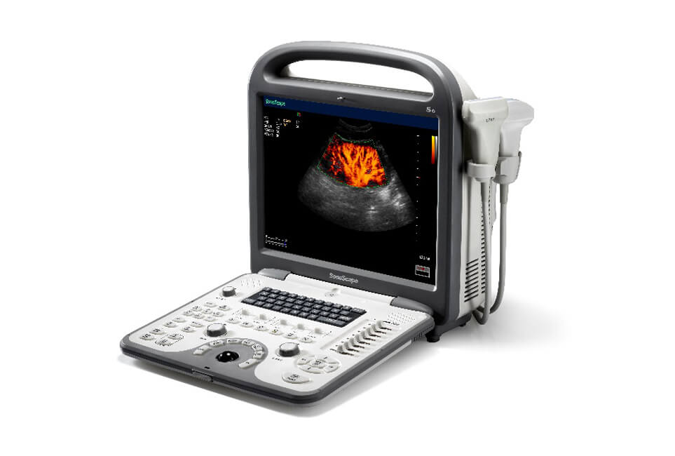 S2 S6 Pro Portable Color Ultrasound