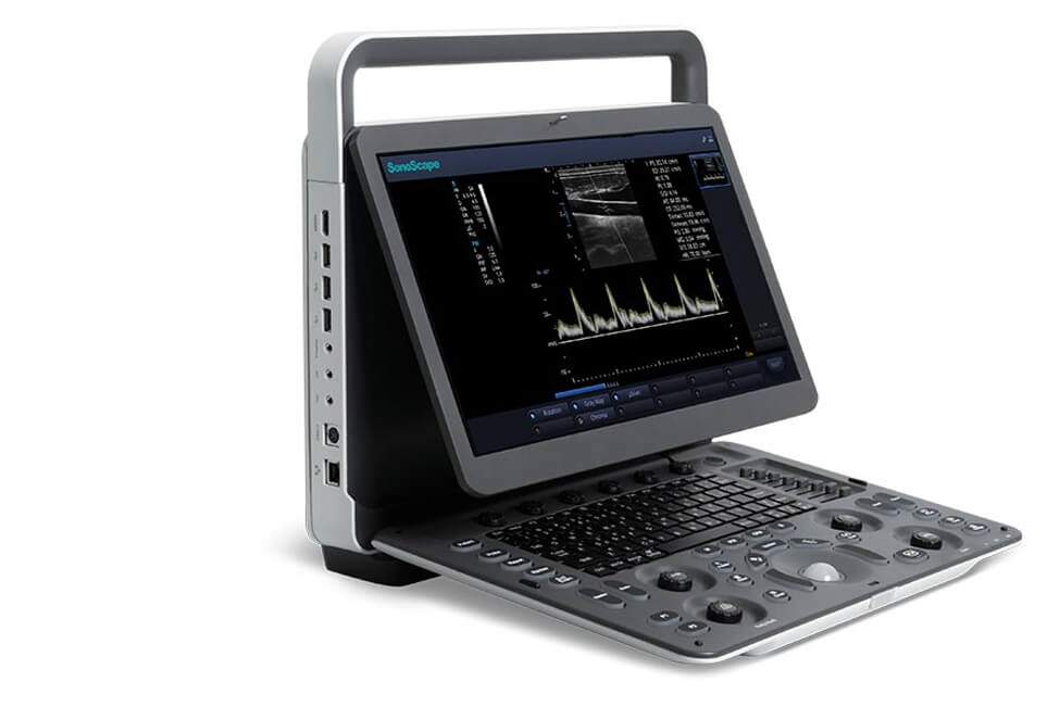 E1 B/W Ultrasound