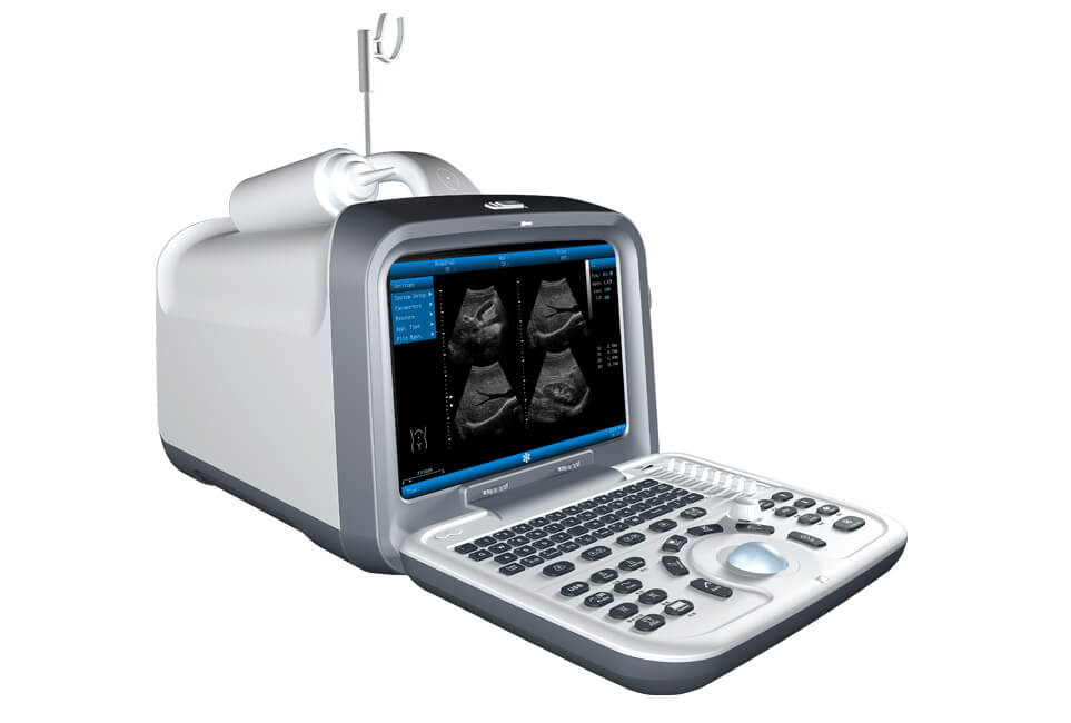 ZQ-6602 B/W Ultrasound