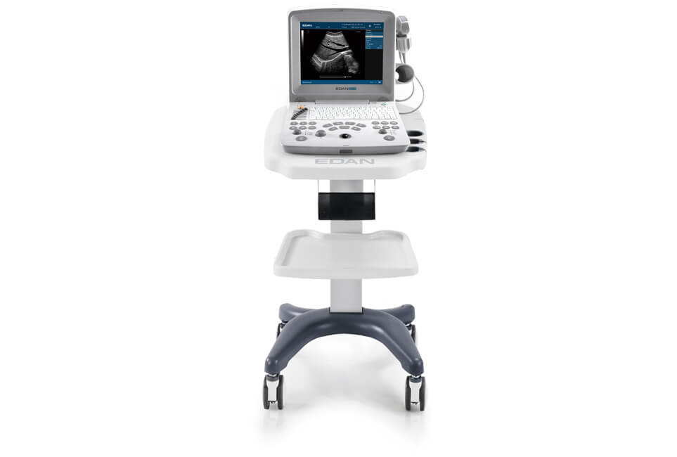 DUS60 B/W Ultrasound