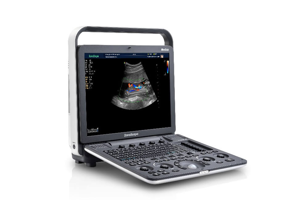 S8 Mobile Ultrasound Device