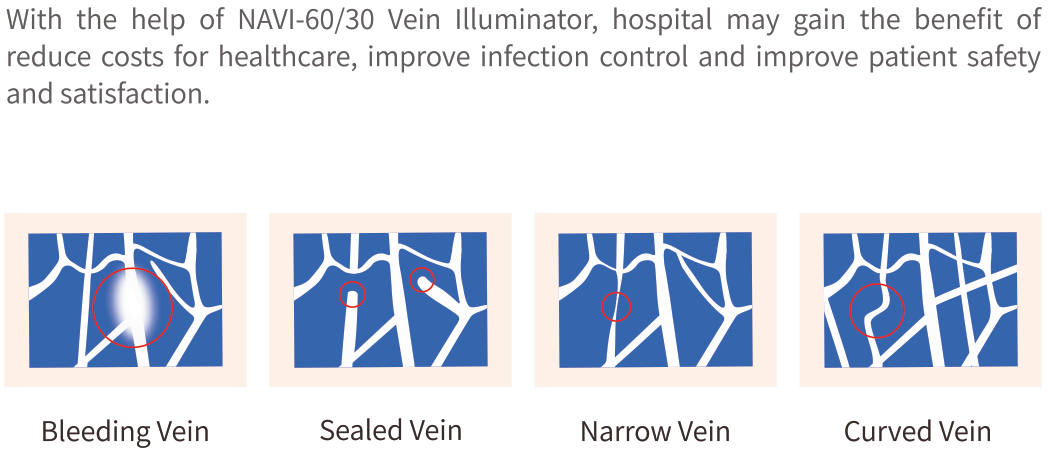 NAVI-60 Led Vein Finder