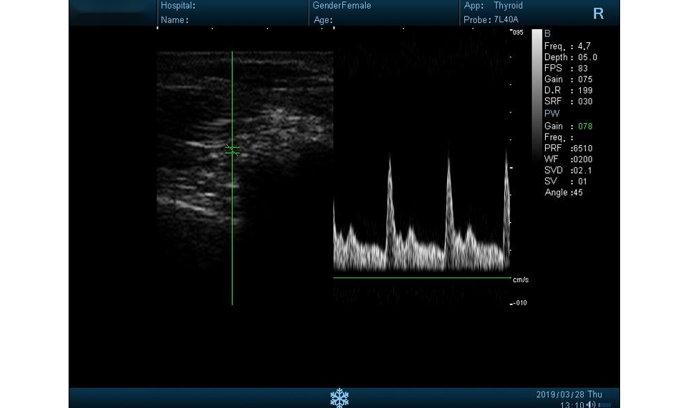 Images of DUS60 B/W Ultrasound1