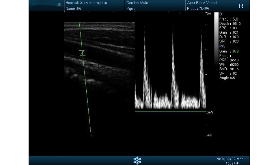Images of DUS60 B/W Ultrasound3