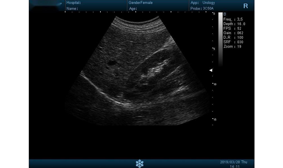 Images of DUS60 B/W Ultrasound6