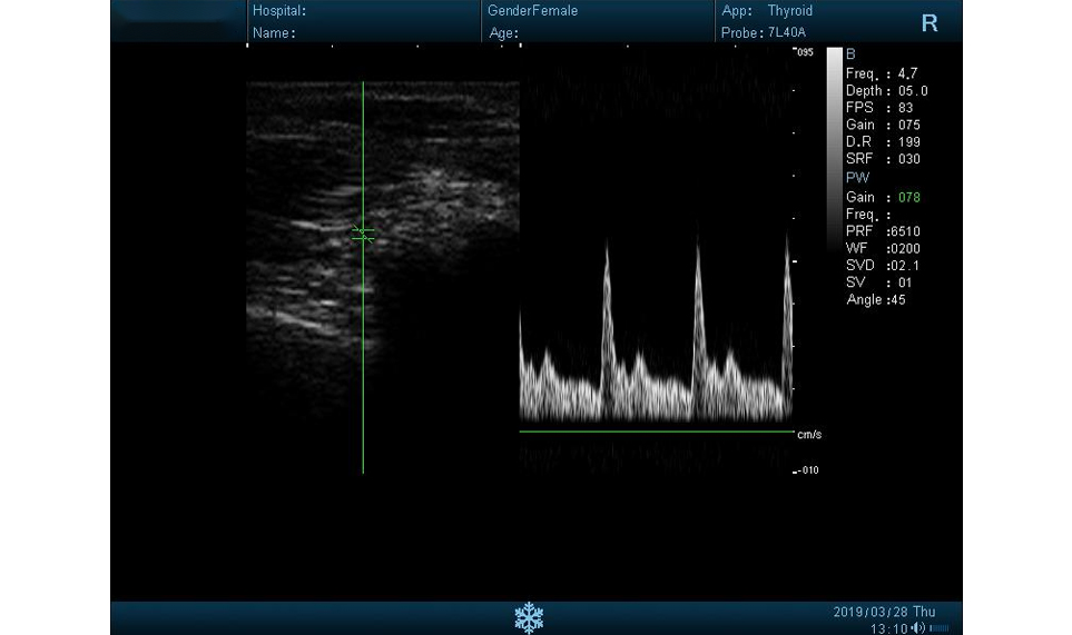 Images of I50 B/W Ultrasound3