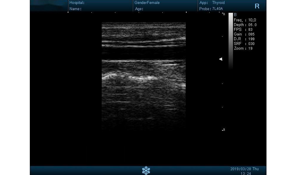 Images of I50 B/W Ultrasound6