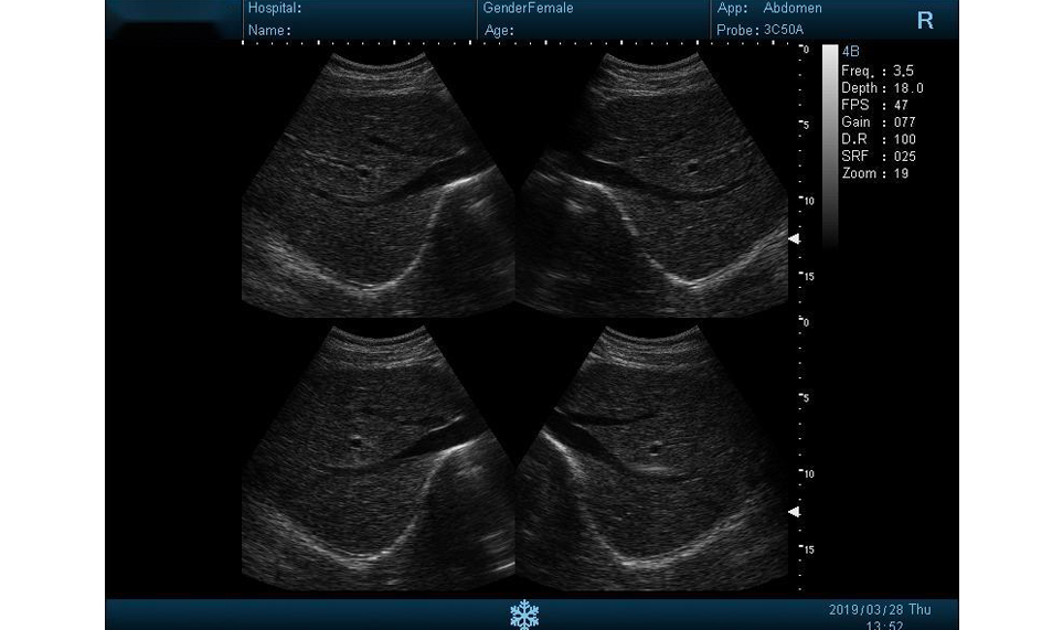 Images of I50 B/W Ultrasound7